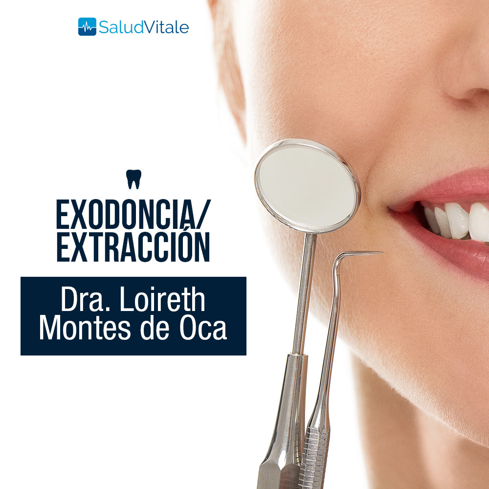 Exodoncia Dental