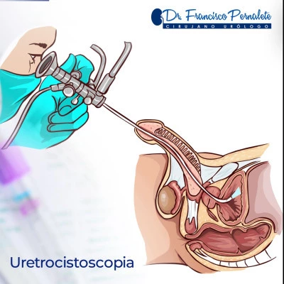 Estudio Uretrocistopico bajo sedacion
