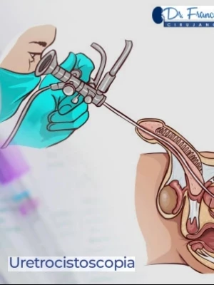 Estudio Cistoscopico bajo sedacion